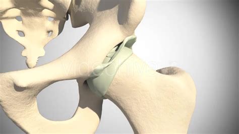 Lesion Of The Acetabular Labrum Hip Quick Download 14941410 Videohive