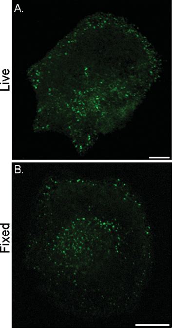 Figure S2 Peripheral Er Pm Junctions Revealed By A Yfp Labelled Stim1