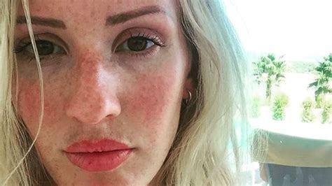 Real Girls With Freckles Popsugar Beauty