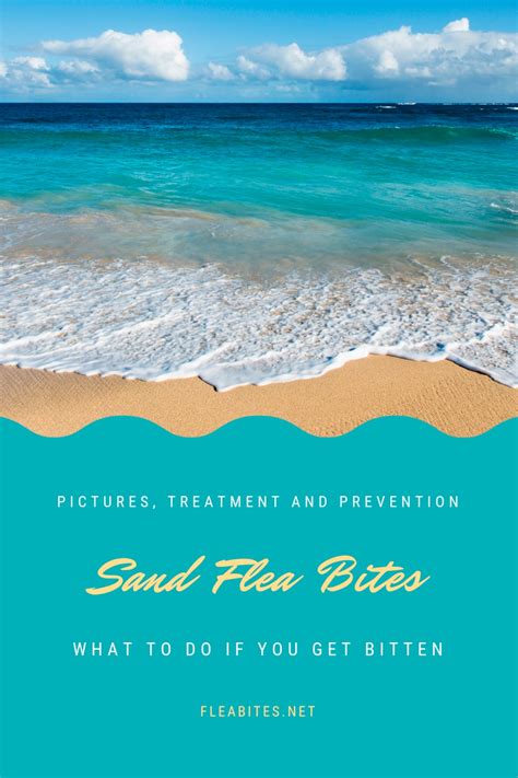Sand Flea Bites On Humans Pictures Treatment And Prevention