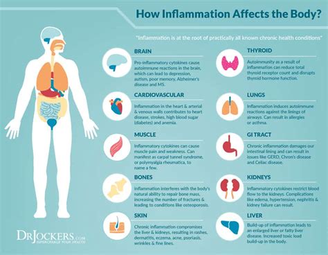 Inflammatory Foods And Chronic Inflammation 101 Mind Over Munch