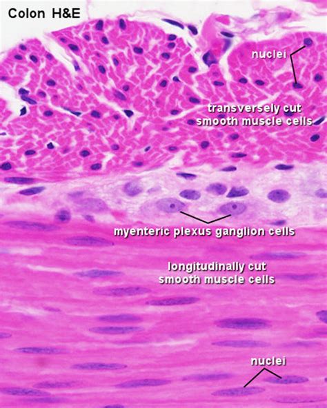 Check out the pronunciation, synonyms and grammar. File:Smooth muscle histology 002.jpg - Embryology