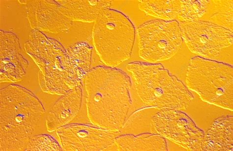 Squamous epithelial cells are usually found in very small numbers in a urine sample. Squamous Epithelial Cells - Stock Image - P616/0476 ...