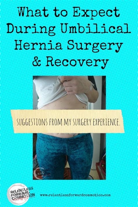 What To Expect During Umbilical Hernia Surgery Recovery Umbilical Hernia Recovery And Surgery