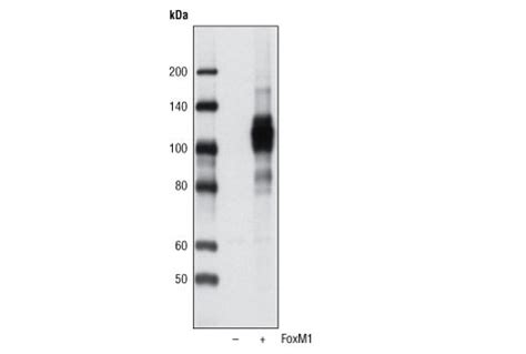 Foxm1 Antibody Cell Signaling Technology