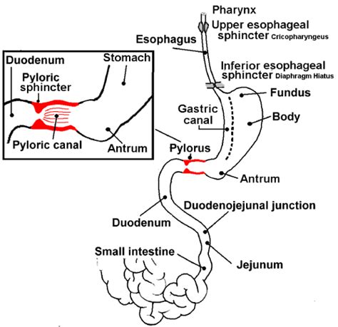 Pathophysiology Of Pyloric Stenosis In Flow Chart Pyloric Stenosis