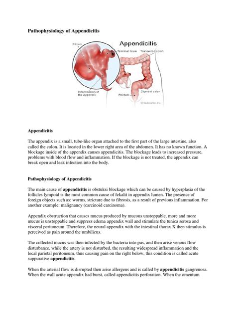 Pathophysiology Of Appendicitis Anatomy Medical Specialties