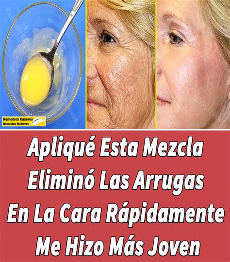 Lista Foto Remedios Caseros Para Las Arrugas De La Cara Y Ojos Actualizar