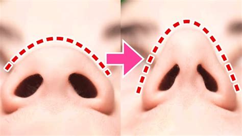 Best Nose Massage To Lift Nose Tip Without Surgery Reshape Nose Fat