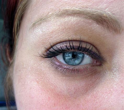 10 Tips To Remove Dark Circles Under Eyes Permanently And Easily