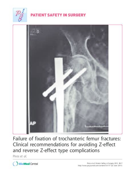 Pdf Failure Of Fixation Of Trochanteric Femur Fractures Clinical