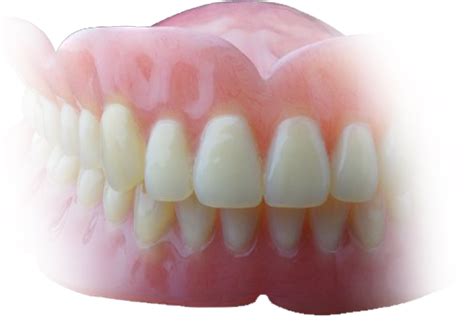 Standard Complete Dentures | Calgary Complete Denture ...