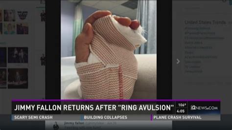 Jimmy Fallon Returns After Ring Avulsion