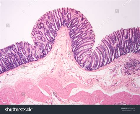 Стоковая фотография 666105634 Histology Colon Human Tissue Show