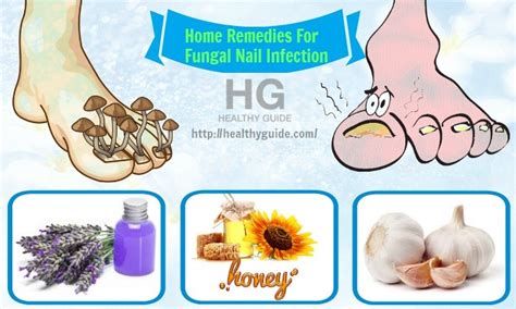 Top 21 Best Home Remedies For Fungal Nail Infection