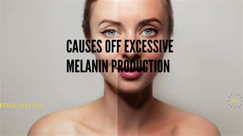 How To Reduce Melanin In An Amazing Way Fast Fitdunia