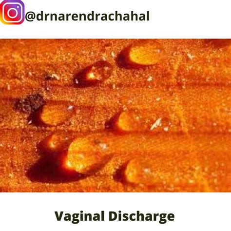 The A Z Of Vaginal Discharge Vaginal Discharge Is Refer Flickr