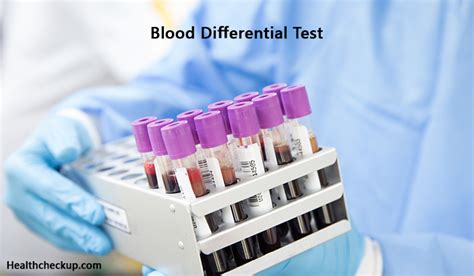 What Is Absolute Neutrophils Blood Test