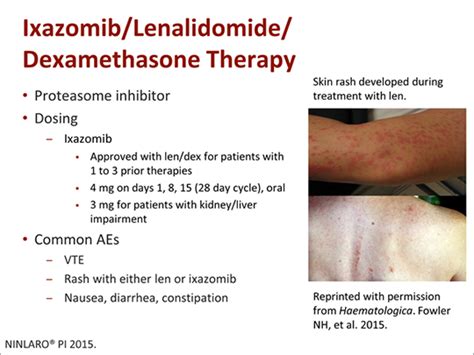 If you have multiple myeloma, the side effects of chemotherapy can cause you to lose your appetite. Nurses' Toolbox: How to Improve Patient Outcomes in ...
