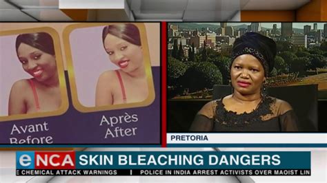 How Widespread Is Skin Bleaching In Sa Youtube