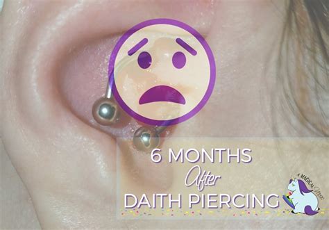 Results 6 Months After Daith Piercing For Migraines