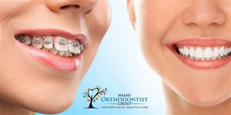 How Can Dentofacial Orthopedics Transform Your Smile