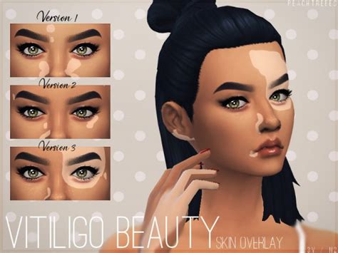 The Sims Resource Vitiligo Beauty Skin Overlay N2 By