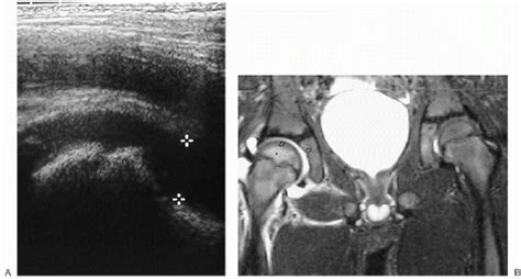 Radiology And Imaging Teachme Orthopedics