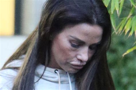 Katie Price Opens Up About Botched Surgery As She Plans To Go Under The