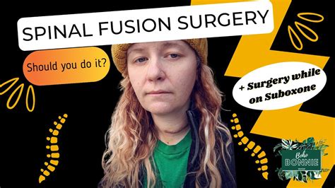 Spinal Fusion Surgery Acdf Should You Do It Plus Surgery While On