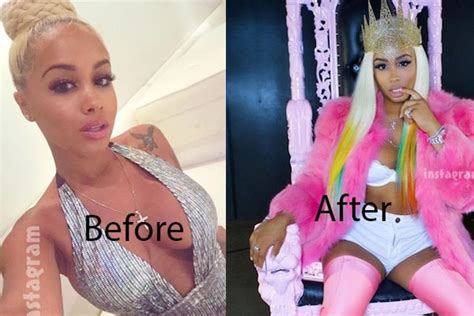 Dreamdolls Plastic Surgery Is Real Pictures Of Before And After