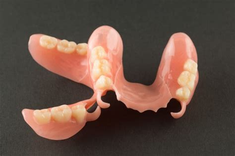 When To Consider Partial Dentures As An Option Frankford Dental Care