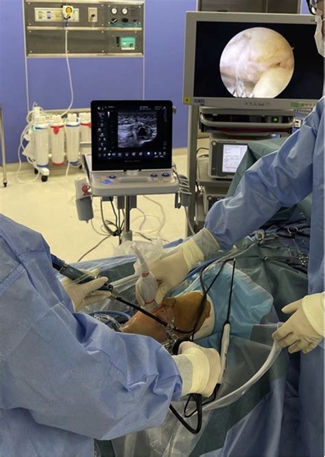 Bursoscopic Ultrasound Guided Ossicle Resection For Osgoodschlatter