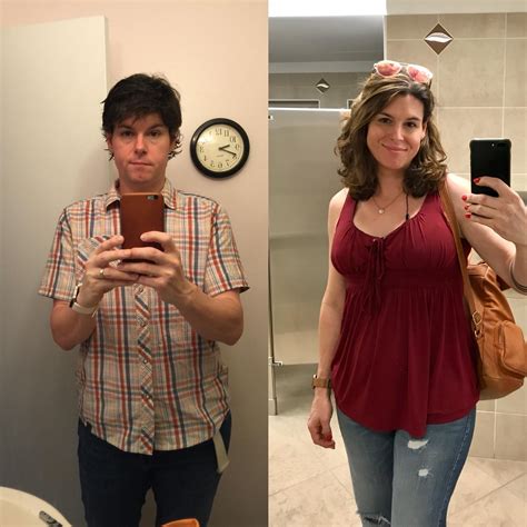 Mtf Body Before After