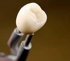 Chauvin family dentistry saratoga springs dentist, clifton park dentist, saratoga springs cosmetic dentist,saratoga springs cosmetic dentistry,clifton park address : Teeth Whitening Specialist - Saratoga Springs, NY & Clifton Park, NY: Chauvin Family Dentistry ...