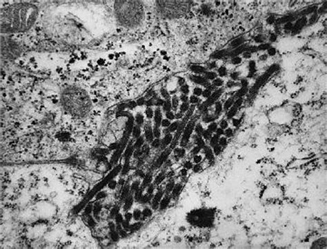 Ebola virus an rna virus almost identical to the marburg virus but serologically distinct; Access Excellence: Viral Images