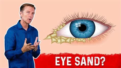 What Causes Crusty Eyes Crusty Eyes Doctor Of Chiropractic Eyes