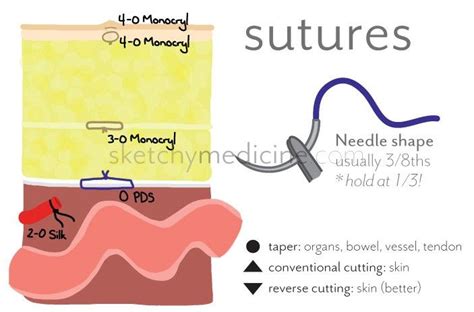Types Of Sutures And When To Use Them Sutures Perioperative