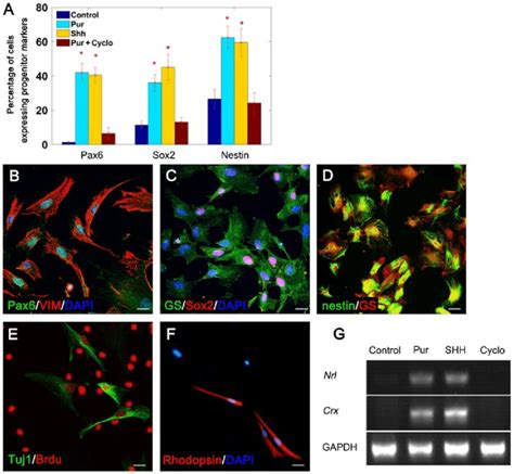 Pdf | müller glial cells span the entire thickness of the tissue, and ensheath all retinal neurons, in vertebrate retinae of all species. Müller glial cells dedifferentiated into progenitor cells ...