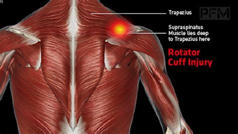 The Ultimate Guide On How To Heal Your Shoulder Pain