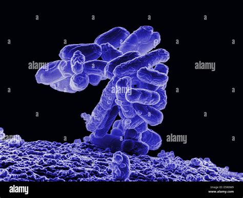 Scanning Electron Micrograph Sem Of A Cluster Of Escherichia Coli
