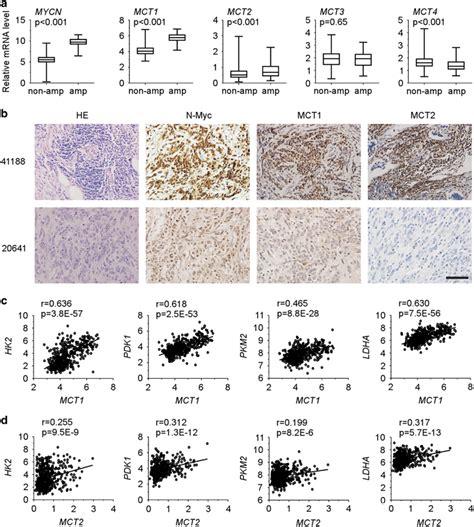 Mct1 And Mct2 Expression Is Significantly Elevated In Mycn Amplified