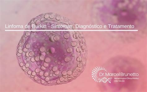 Linfoma De Burkitt Tipos Sinais Sintomas Est Gios Tratamento Taxa