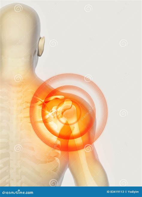 Shoulder Painful Skeleton X Ray 3d Illustration Stock Illustration