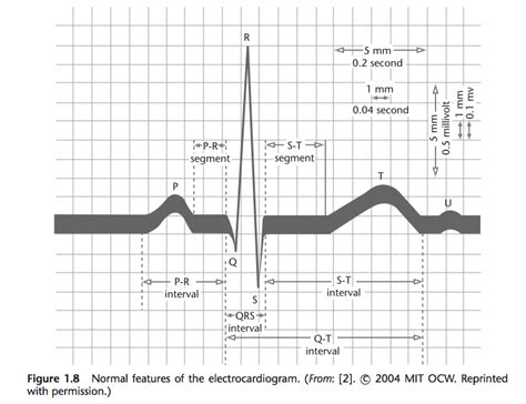 Normal Features Of The Electrocardiogram Ekg