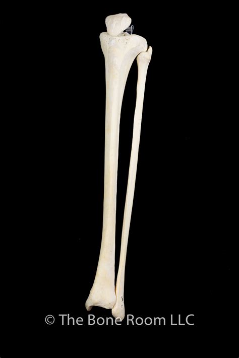Articulated Human Patella Tibia And Fibula Set