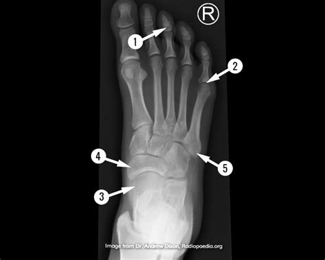 Foot X Ray Anatomy
