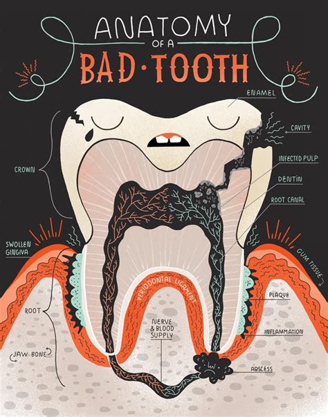 Anatomy Of A Good Tooth And Bad Tooth Two Art Print Set Etsy Norway