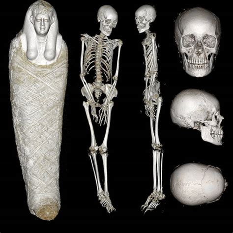 Pdf 3d Reconstruction Of The Ancient Egyptian Mummy Skeleton From The Pushkin State Museum Of