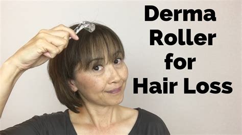 Derma Roller On Scalp For Hair Loss Massage Monday 440 Youtube